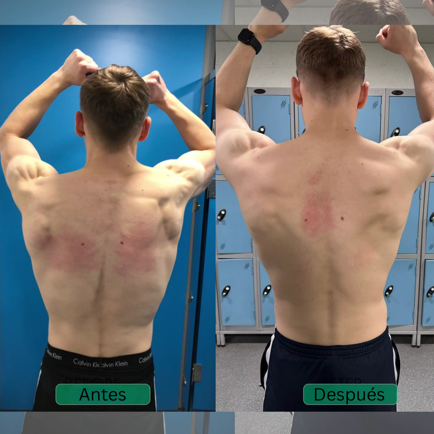 Cradella™ Corrector de postura y soporte para la espalda