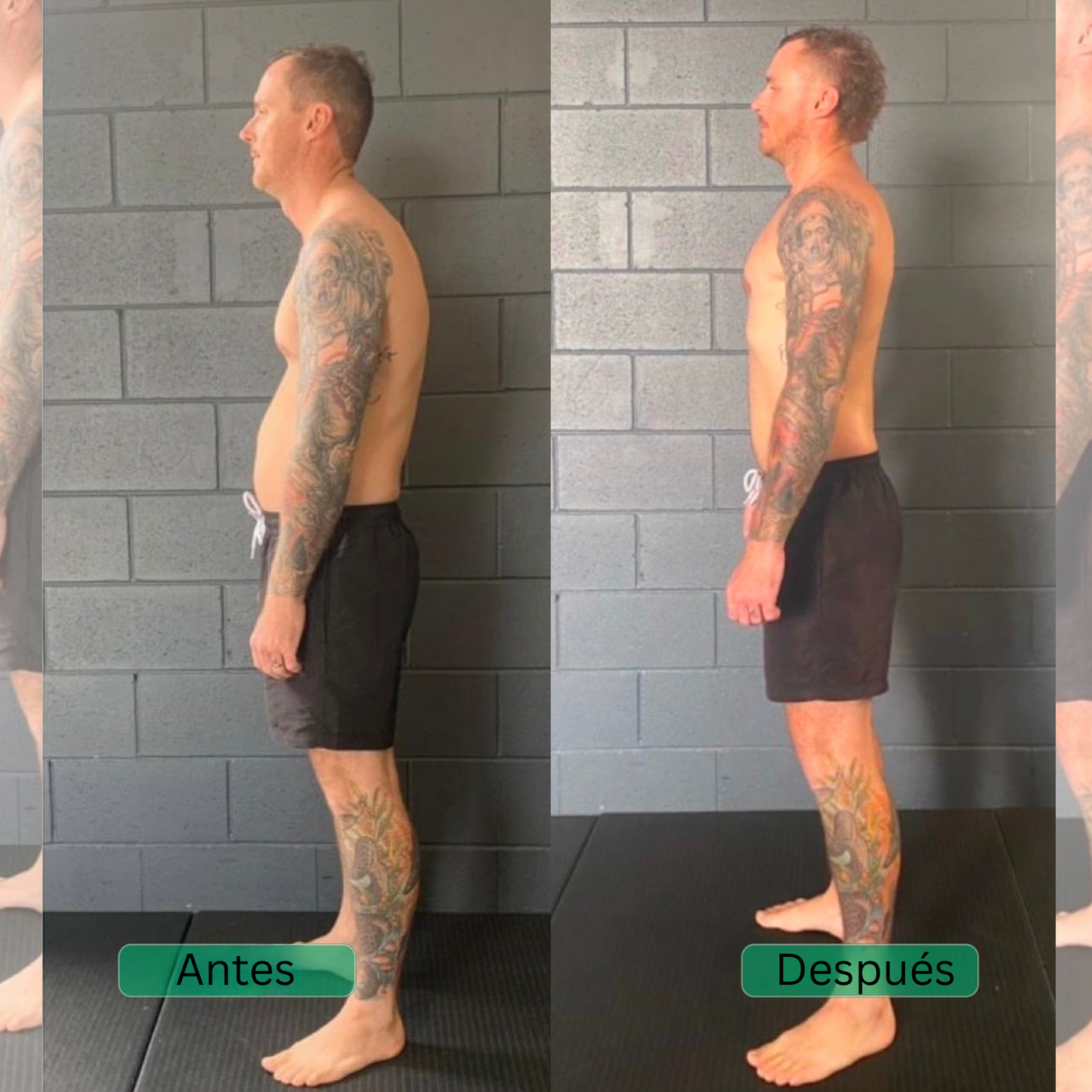 Cradella™ Corrector de postura y soporte para la espalda